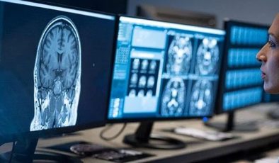 Alzheimer vakaları neden arttı?
