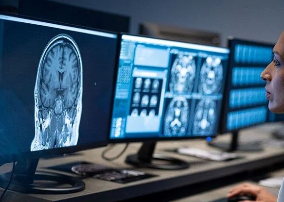 Alzheimer vakaları neden arttı?