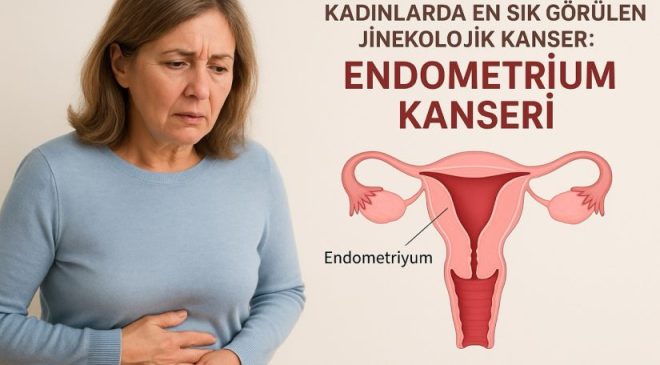 Kadınlarda En Sık Görülen Jinekolojik Kanser: Endometrium Kanseri
